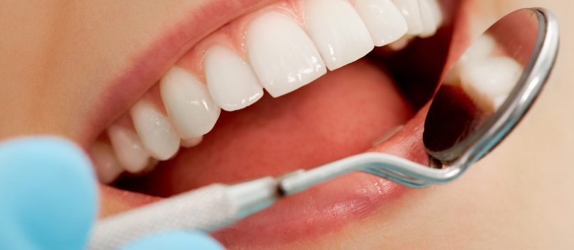 Dental Veneers Treatment Melbourne